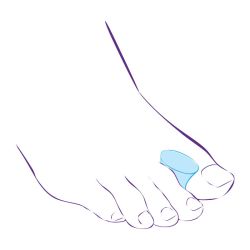 СТ-31 Межпальцевая перегородка