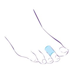 СТ-45 Приспособление корригирующие (кольцо защитное)