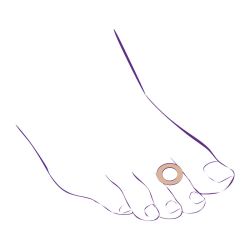 СТ-63 №9 Антимозольное кольцо