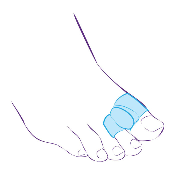 Межпальцевая перегородка с кольцами на 1-й и 2-й пальцы СТ-54.2  Trives